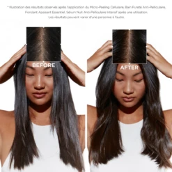 Micro-Peeling Cellulaire Symbiose Kérastase 200ml -Haircare Soldes Sans titre 350 350 px 500 500 px 280 280 px 140 140 px 350 350 px 1200 1200 px 13 95961.1684847692